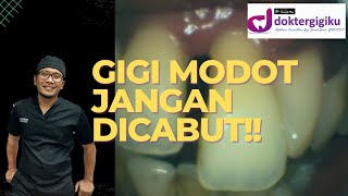 PERAWATAN GIGI DEPAN MODOT HAMPIR COPOT (EXTRUDED)