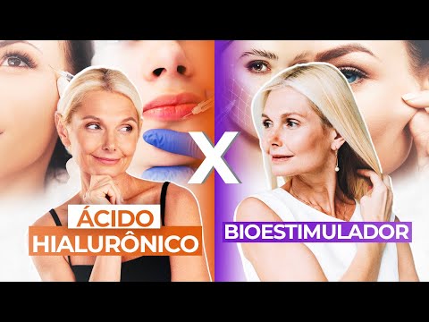 Qual a diferença entre BIOESTIMULADOR DE COLÁGENO E ÁCIDO HIALURÔNICO? Qual usar?
