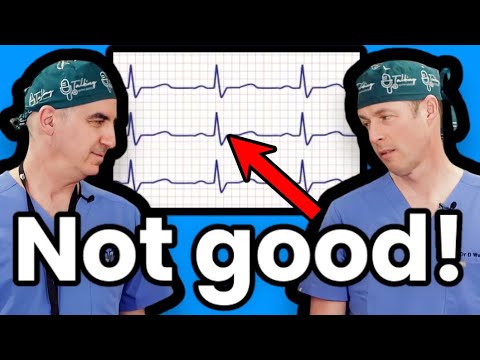 Heart Murmurs: Heart Sounds You Should Be Worried About