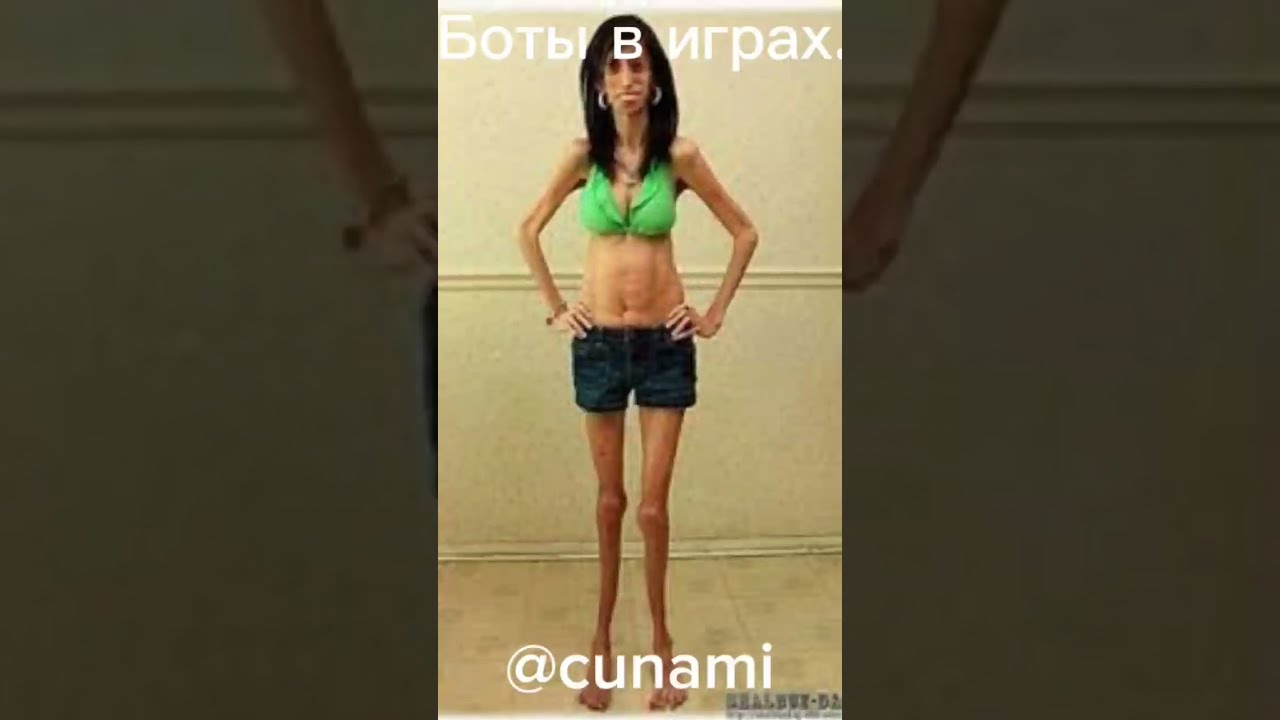 Фото Самой Худой Девушки Фото Самой Худой Девушки
