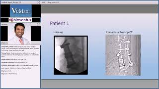 Discitis/Osteomyelitis Lumbar Case Review