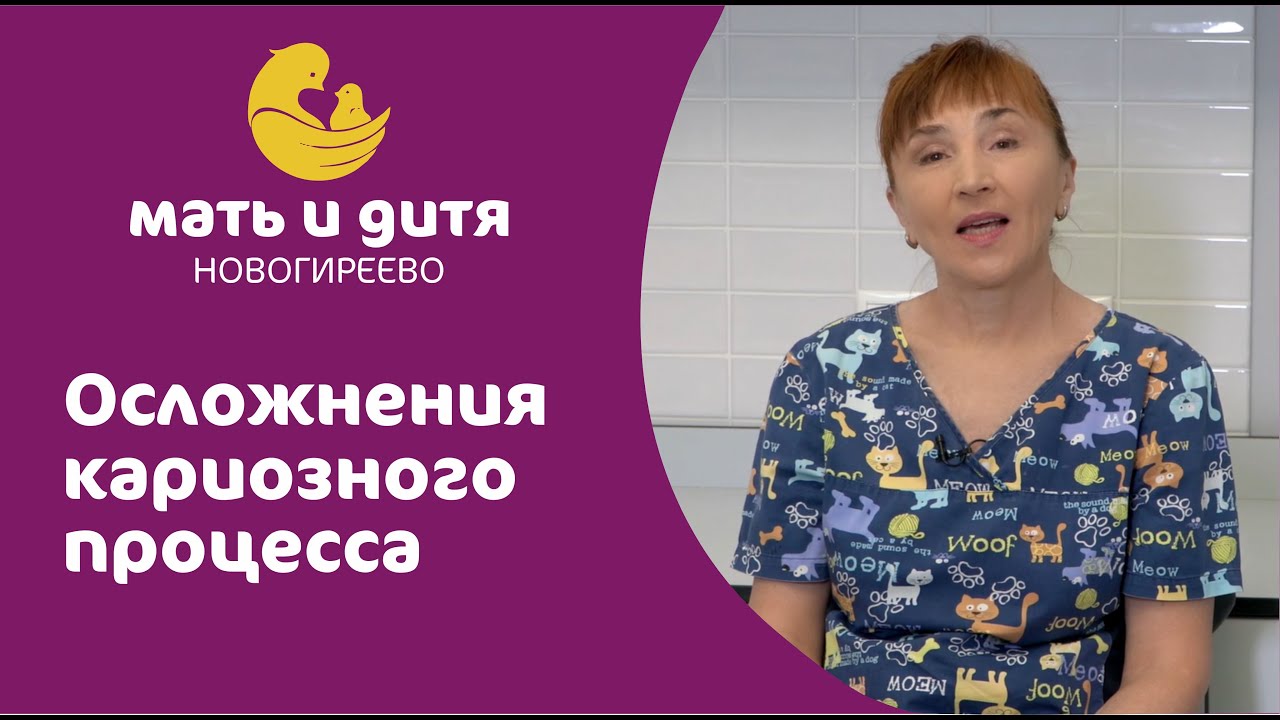 Осложнения кариозного процесса - YouTube