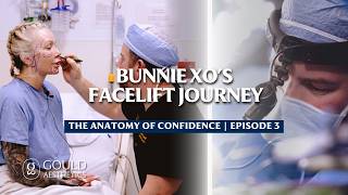 Bunnie XO's Deep Plane Facelift Journey | The Anatomy of Confidence Episode 3