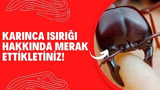 Karınca Isırığı Hakkında Merak Ettikleriniz - Ilaclama.tr