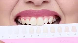 Instant White Teeth (Pen) - Dermatrisse