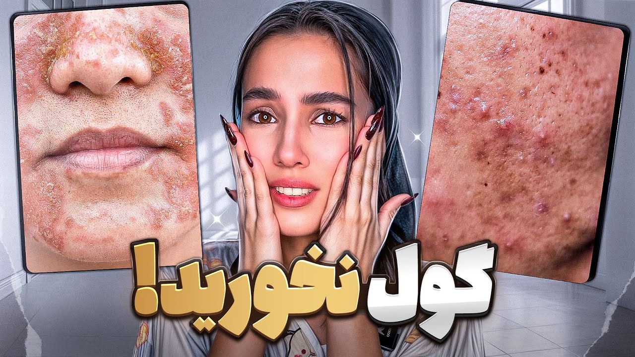 این 10 تا محصول پوستمو داغووون کرد😭 (اصلا نخرید !!)