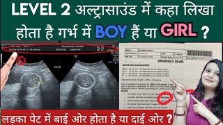 Level 2 scan me kaha likha hota hai BOY hoga ya GIRL || Gender prediction by Level 2 scan