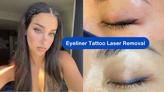 PMU Tattoo Laser Removal Session 1 | Eyeliner Tattoo Removal