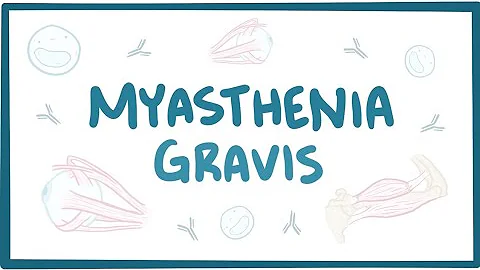Myasthenia gravis Nursing NCLEX Review Symptoms, Treatment,. Pathophysiology Intervention