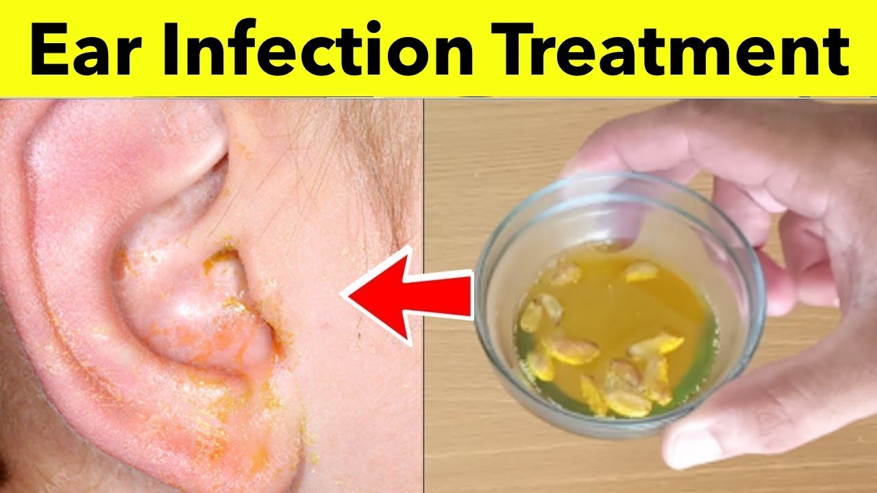 how to treat a ear infection