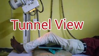 Knee Tunnel View | Beclere Method