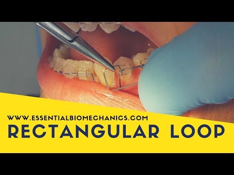 Rectangular loop | Essential Biomechanics
