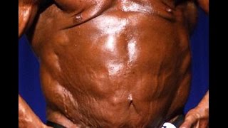 New Bodybuilding Disease: Lennyism