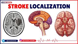2. Stroke Localization | Neurology Internal Medicine | USMLE Step 2 CK Clinical Neuro Review
