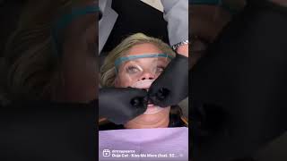 How Veneers Are Placed