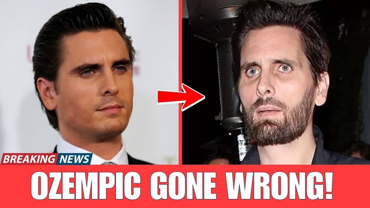 10 Most Shocking Ozempic Celebrity Transformations You Won’t Believe | Then and Now 2026