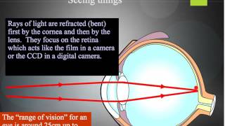 P3.2 The Eye and Sight Problems