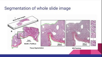 Data-Efficient and Weakly Supervised Computational Pathology on Whole Slide Images - Paper Summary