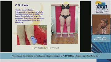 ¿Cuáles son las causas del lipoedema en las piernas?