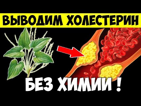 Не пейте статины - не посмотрев это видео. Холестерин сбежит от вас сам