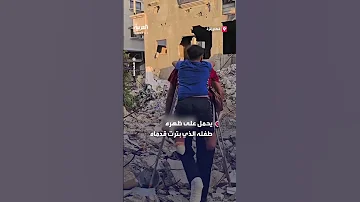 أب في غزة يمشي على عكازتين حاملا طفله الذي بترت قدماه في القصف 