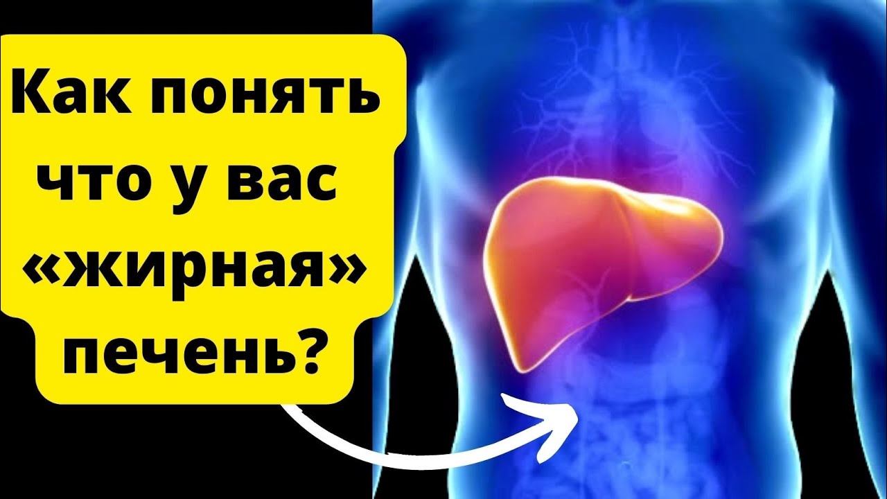 ЖИРНАЯ ПЕЧЕНЬ:симптомы,причины,лечения. Жировой гепатоз - YouTube