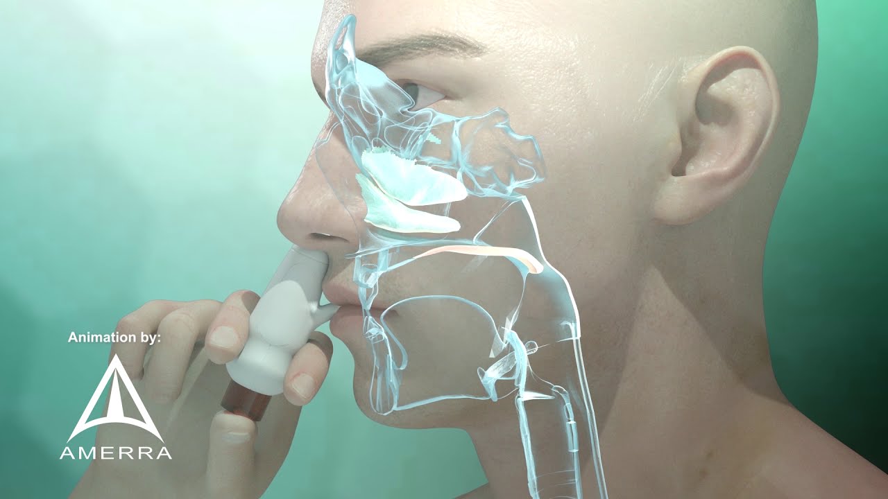 Fluticasone Nasal Spray - 3D Medical Animation