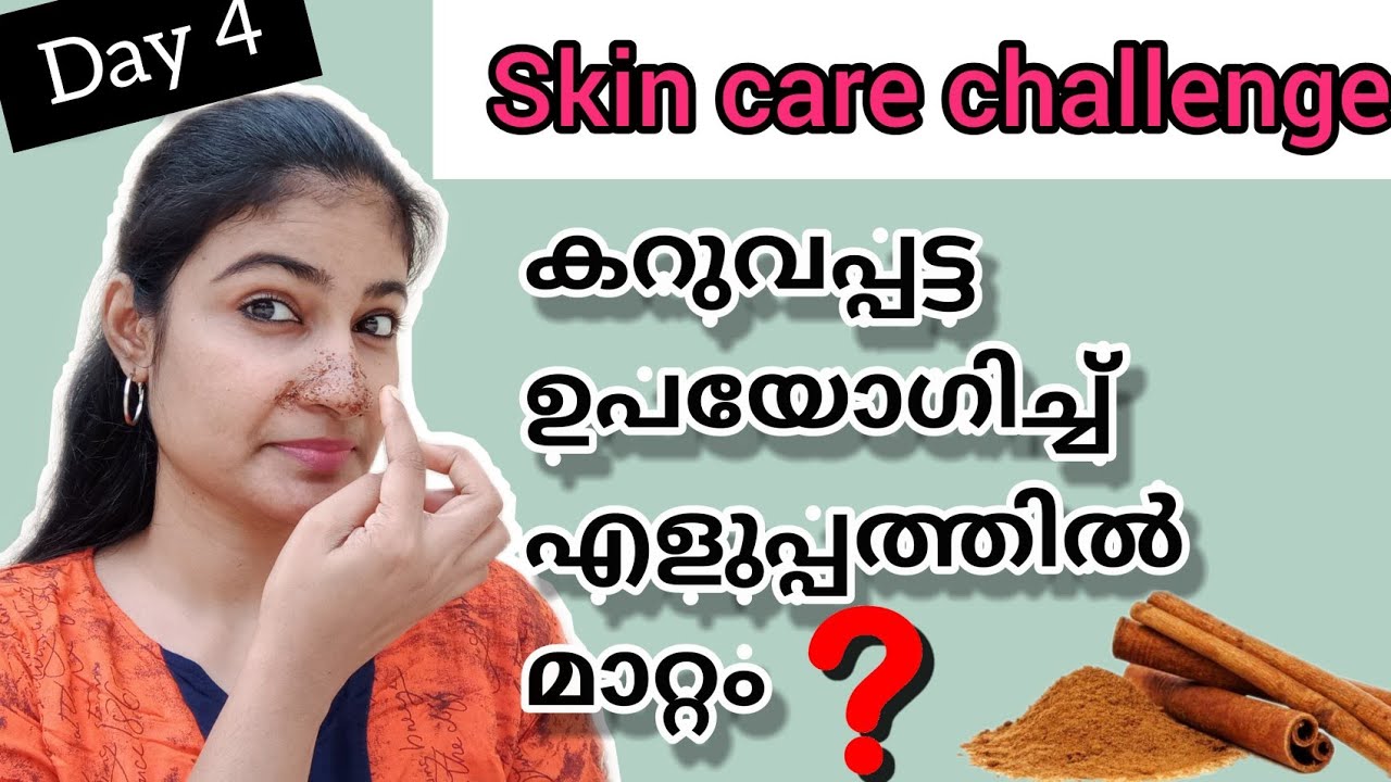 Cinnamon Face MaskPermenant Solution For Blackhead/Whitehead/Acne