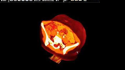 MITO - Medical Imaging Toolkit