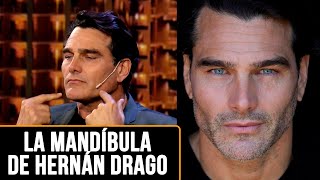 El Rey Del Mewing La Técnica De Hernán Drago Para Tener Una Mandíbula Perfecta