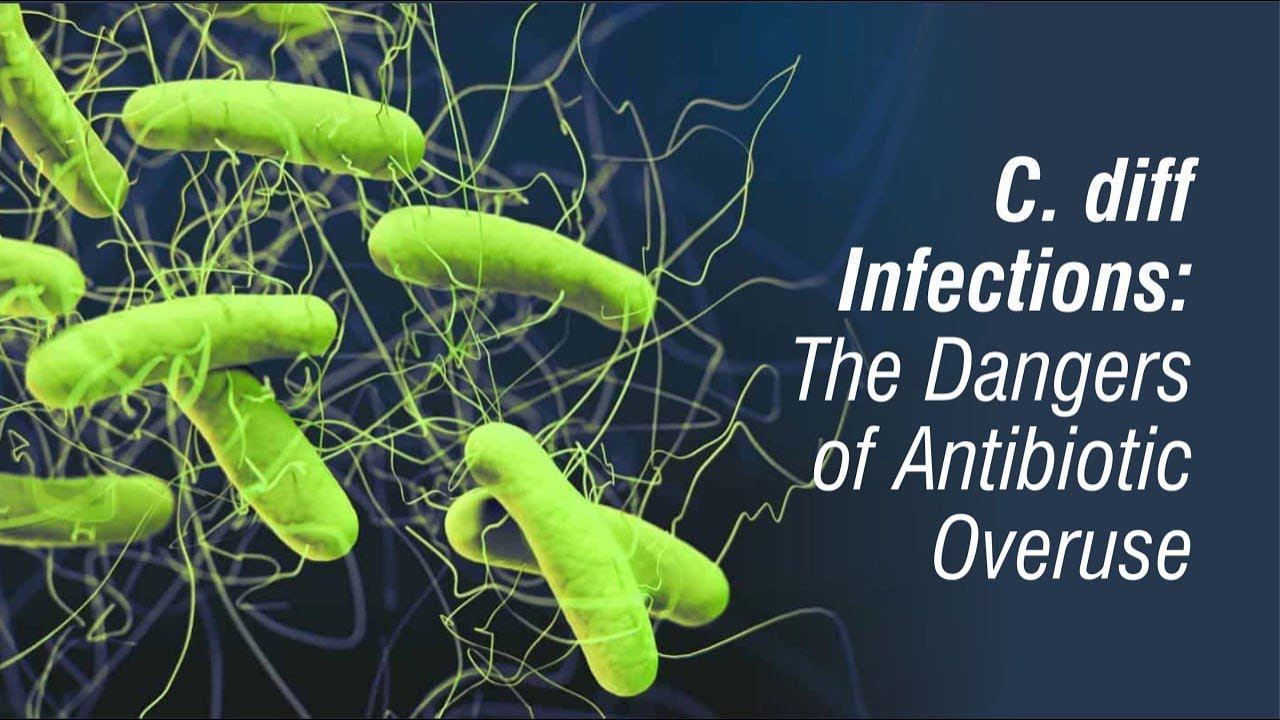 C diff Infections: The Dangers of Antibiotic Overuse #healthtips # ...
