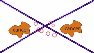 How Targeted Therapy Avastin (Bevacizumab) Treats Metastatic Cancer