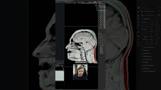 π§ Blender MRI Visualizer Tool! #blender
Iβve made my personal MRI visualization file available to my silver-tier patrons at curtisholt.online/members.
#b3d #blender3d π§ Blender MRI Visualizer Tool! #blender