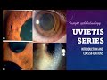Uveitis series  classification types and pathology of uveitis