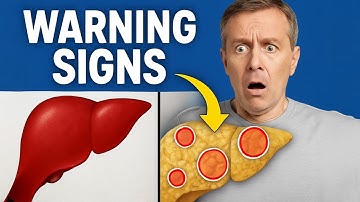 Fatty Liver Disease | WARNING Signs You Shouldn