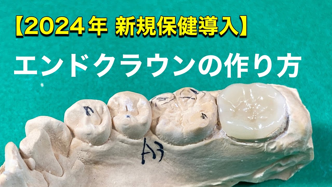 歯科技工 全12巻セット 2024 年 QDT 2023年12月号 - クインテッセンス出版