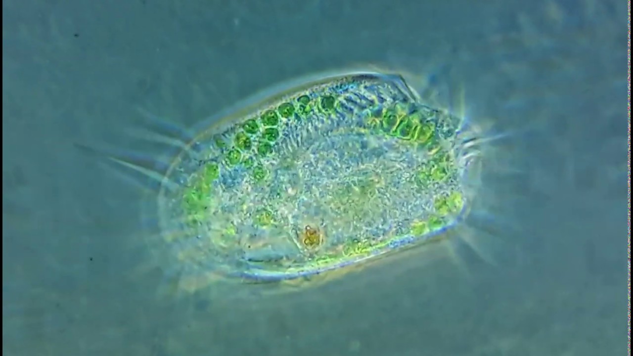 Инфузория Euplotes с симбиотическими водорослями. \ Ciliate Euplotes with symbiotic algae.