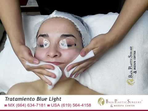 Blue Light Acne treatment in Tijuana Mexico-Tratamiento Blue Light Tijuana