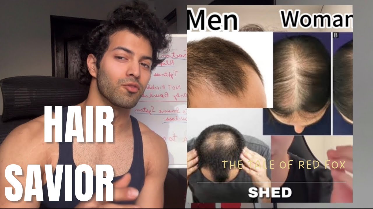 STOP Hairfall before it’s too late! A Complete Hairfall Guide for men and women 