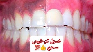 🥶🦷عندك لثة زرقة بسبب لي فيكس او لثة مريضة و مقيحة ها هو الحل غسول رائع screenshot 5