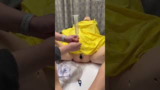 How to backfill a bladder for voiding trial