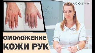 ОМОЛОЖЕНИЕ РУК ✋ ВЕНЫ И ПЯТНА НА РУКАХ КАК УБРАТЬ?