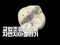 자연치아살리기 교합조정만으로도 가능하다? ㅣ 부산잇몸치료 잘하는 동래구치과 닥터배