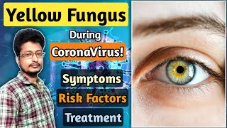 Yellow Fungus Kya He | Yellow Fungus Symptoms | Yellow Fungus Covid