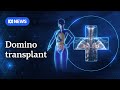 Meet the triple organ transplant recipient from Queensland who defied the odds | ABC NEWS