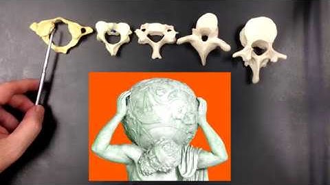 Individual Vertebrae with Structures