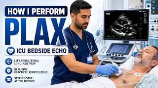 How I Perform PLAX in ICU Patients | Bedside Echocardiography