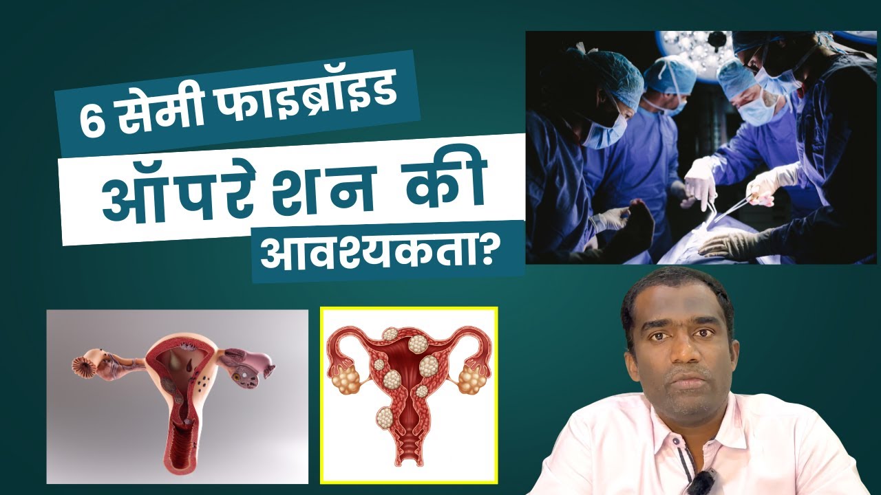 6 cm Fibroid - Is Surgery Necessary? || Treating Uterine Fibroids without Surgery