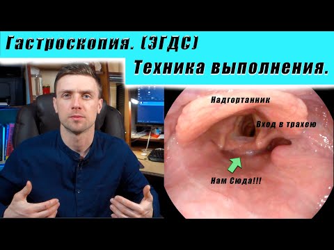 Гастроскопия +биопсия. Реальное видео. как делать? Как вводить гастроскоп?  Техника выполнения.