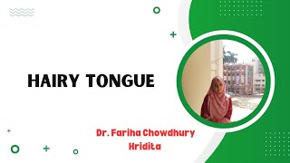 Hairy Tongue